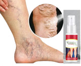 Varcose Venis Spray (Pack of 1)