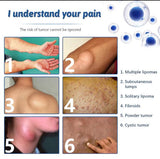 Doctor's No 1 choice | Lipoma Removal Cream (Pack of 2)