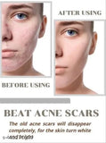 Niacid Face Serum -Skin Brightening & Anti-Aging Formula Repairs and Hydrates (Pack of 2)