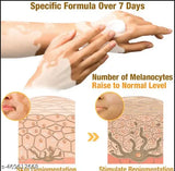 Vitiligo Bee Venom Treatment Cream (Pack of 2)