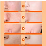 Exfoliating Kojic Acid Turmeric Spray (400 ml) – Pack of 2